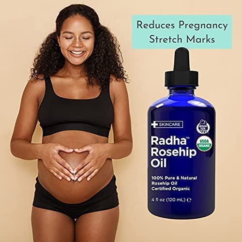 Radha Beauty Organic Rosehip Seed Oil – 100% Pure Cold-Pressed (4 oz)