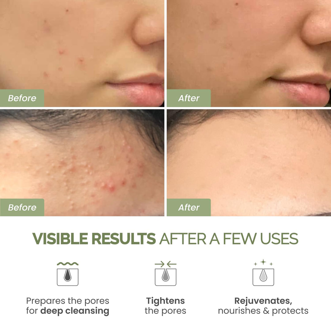 Plantifique Korean Clay Mask | Hydrating Mud Mask with Avocado & Superfoods | Vegan & Dermatologist Tested | 100ml