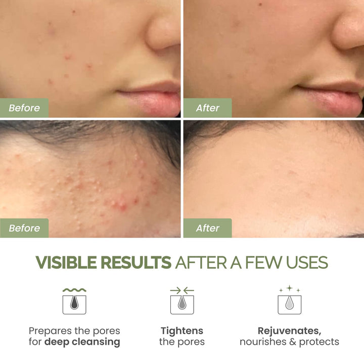 Plantifique Korean Clay Mask | Hydrating Mud Mask with Avocado & Superfoods | Vegan & Dermatologist Tested | 100ml