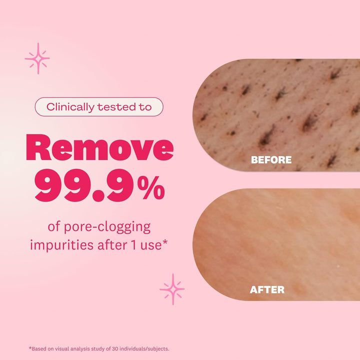 The Face Shop Rice Water Bright Foaming Facial Cleanser, 150ml – Gentle Hydrating Face Wash