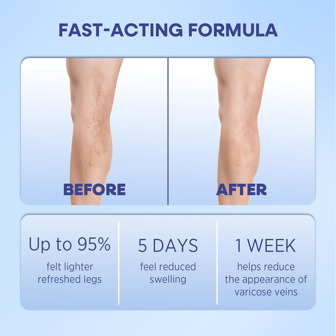 Hermon Varicose Vein Cream for Legs 150ml – Natural Formula for Circulation & Skin Smoothing