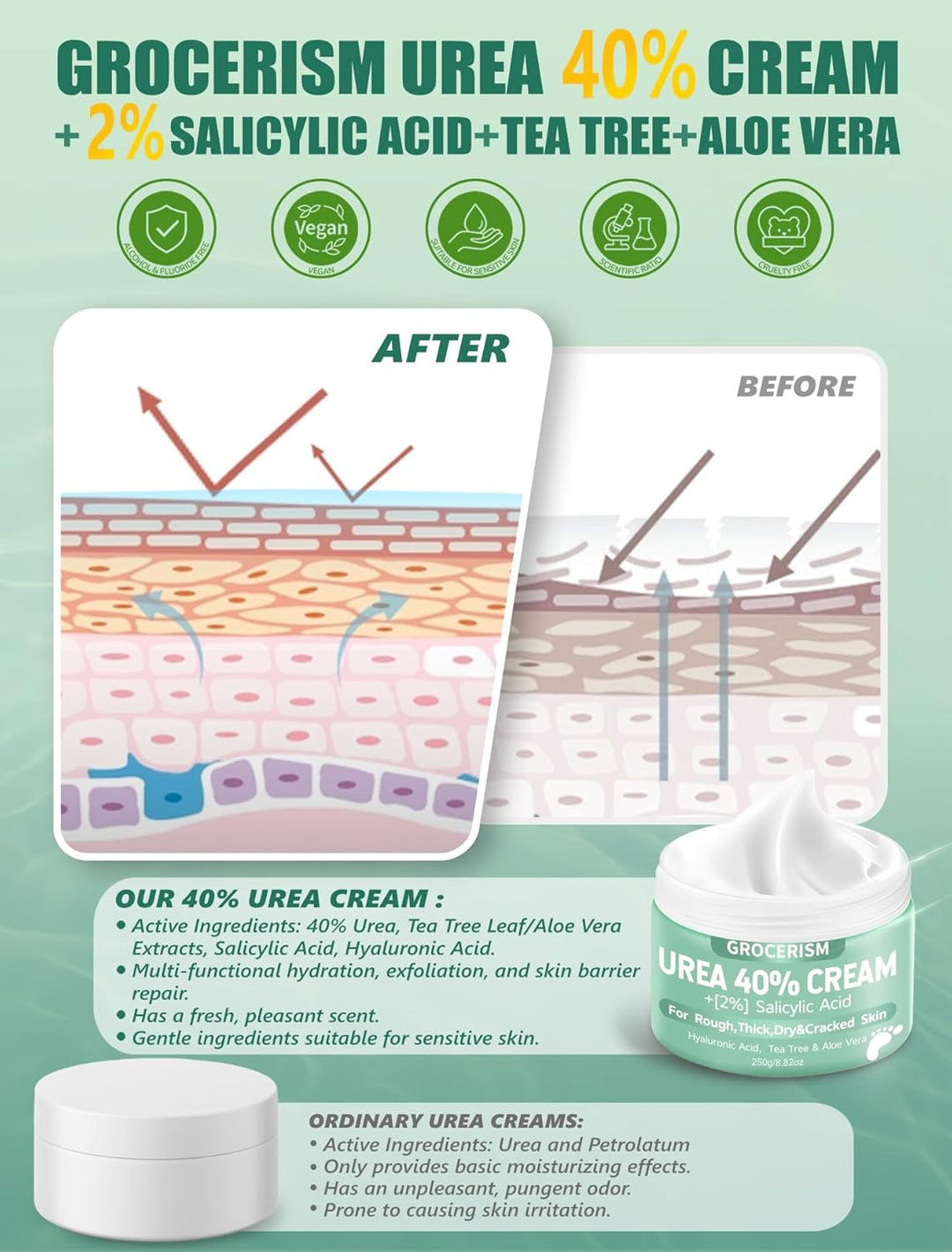 Grocerism Urea 20% Cream packaging with before and after illustration on a light green background