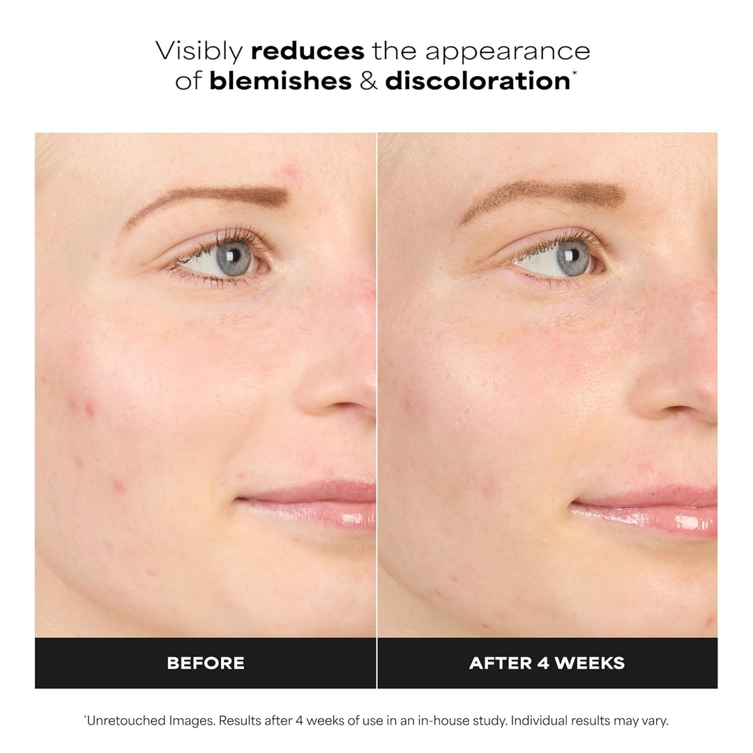 Paula's Choice BOOST 10% Azelaic Acid Booster Cream Gel Face Serum