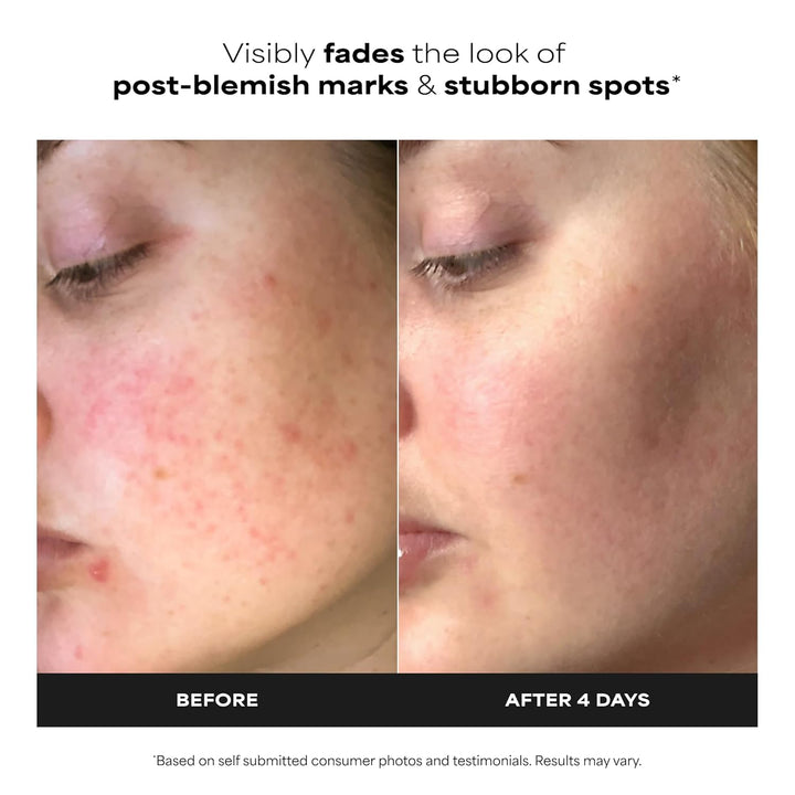 Paula's Choice BOOST 10% Azelaic Acid Booster Cream Gel Face Serum