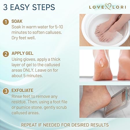 LOVE LORI Callus Remover for Feet (Extra Strength) Foot Callus Remover Gel