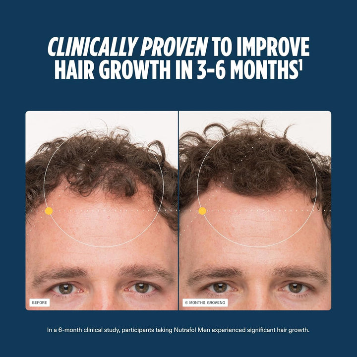 Nutrafol Men’s Hair Wellness Supplement – Supports Hair Strength & Scalp Health – 1 Month Supply (Refill Pouch)
