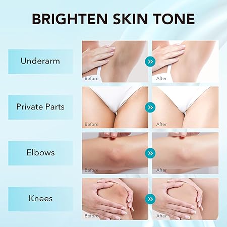 VZP Skin Brightening Cream for Dark Spots & Uneven Tone 50ml – For Face, Underarms, Knees & Bikini Area