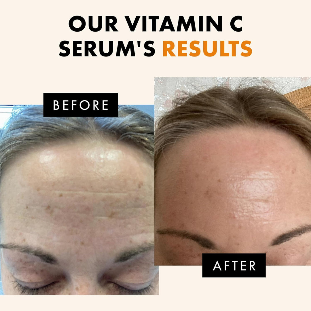 Eclat Skincare Vitamin C Serum - 1 Fl Oz