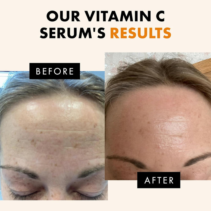 Eclat Skincare Vitamin C Serum - 1 Fl Oz