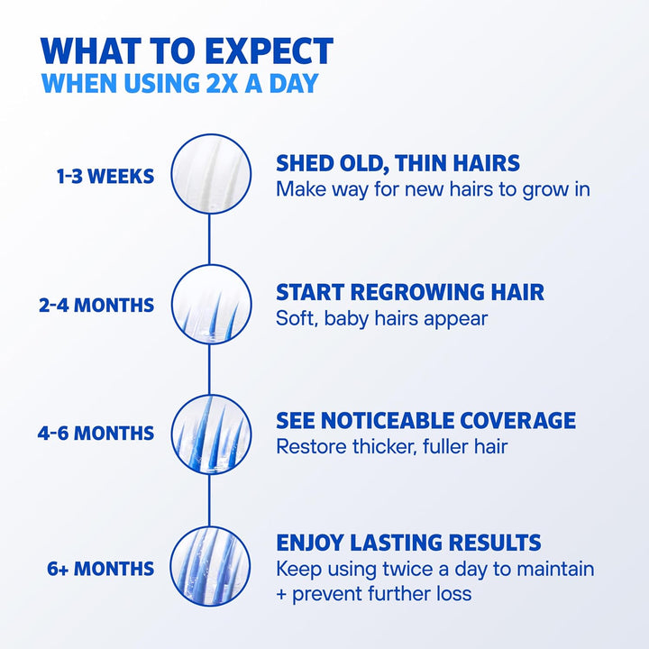 Men’s Rogaine Extra Strength 5% Minoxidil Topical Solution (3 Month Supply)