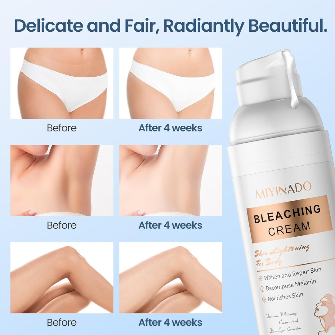 Miyinado Skin Brightening Cream with Vitamin C – Dark Spot Corrector for Underarms, Knees, Elbows & Bikini Area (50ml)