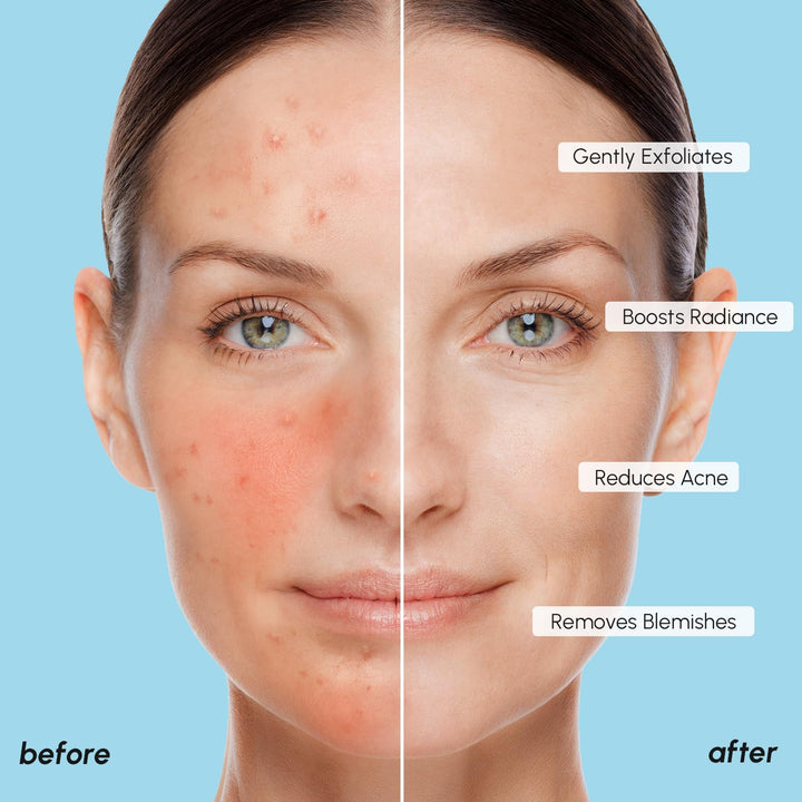 MAREE Glycolic Acid Toner Pads with Salicylic Acid – Exfoliating & Brightening Face Pads