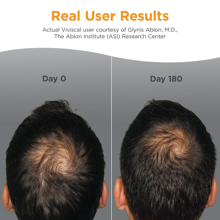 Viviscal Men Hair Growth Supplements for Men - 60 Tablets