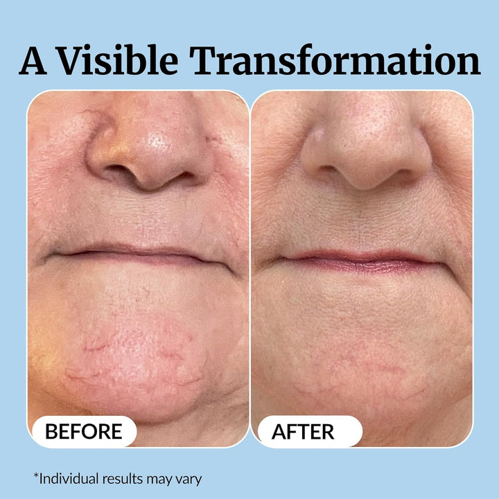 Vibriance Super C Serum for Mature Skin -  1 fl oz