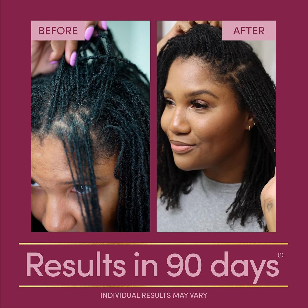 Nature’s Bounty Optimal Solutions Hair Growth Supplement with Biotin, Arginine & Silicon – 30 Capsules, 1-Month Supply, Thicker Fuller Hair for Women