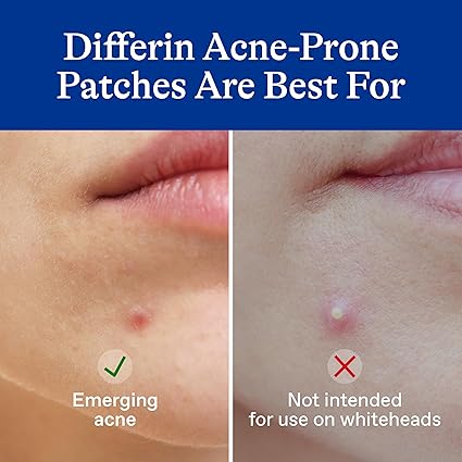 Differin Skin Care Patches – 36 Count