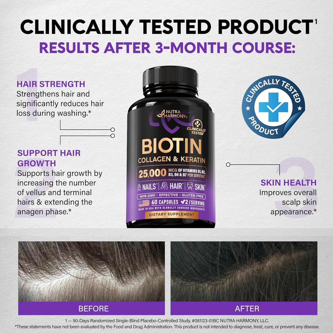 Nutra Harmony Hair Growth Vitamins with Biotin, Collagen & Keratin, 60 Capsules