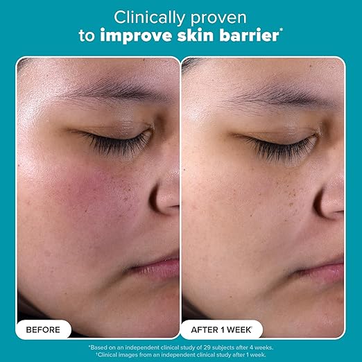 Paula's Choice SKIN PERFECTING 2% BHA Liquid Salicylic Acid Exfoliant-Facial Exfoliant for Enlarged Pores, Wrinkles & Fine Lines and Suitable for Blackhead-Prone Skin