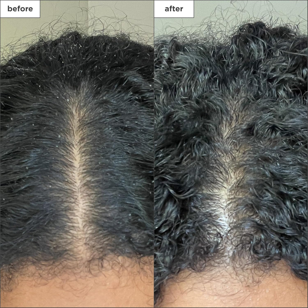 Briogeo Scalp Revival Charcoal Exfoliating Shampoo – Sulfate-Free Scalp Scrub for Dandruff, Oily & Itchy Scalp | Hydrating Coconut Oil | Vegan - 8oz