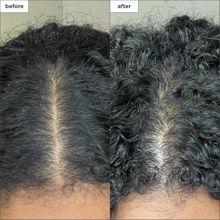 Briogeo Scalp Revival Charcoal Exfoliating Shampoo – Sulfate-Free Scalp Scrub for Dandruff, Oily & Itchy Scalp | Hydrating Coconut Oil | Vegan - 8oz