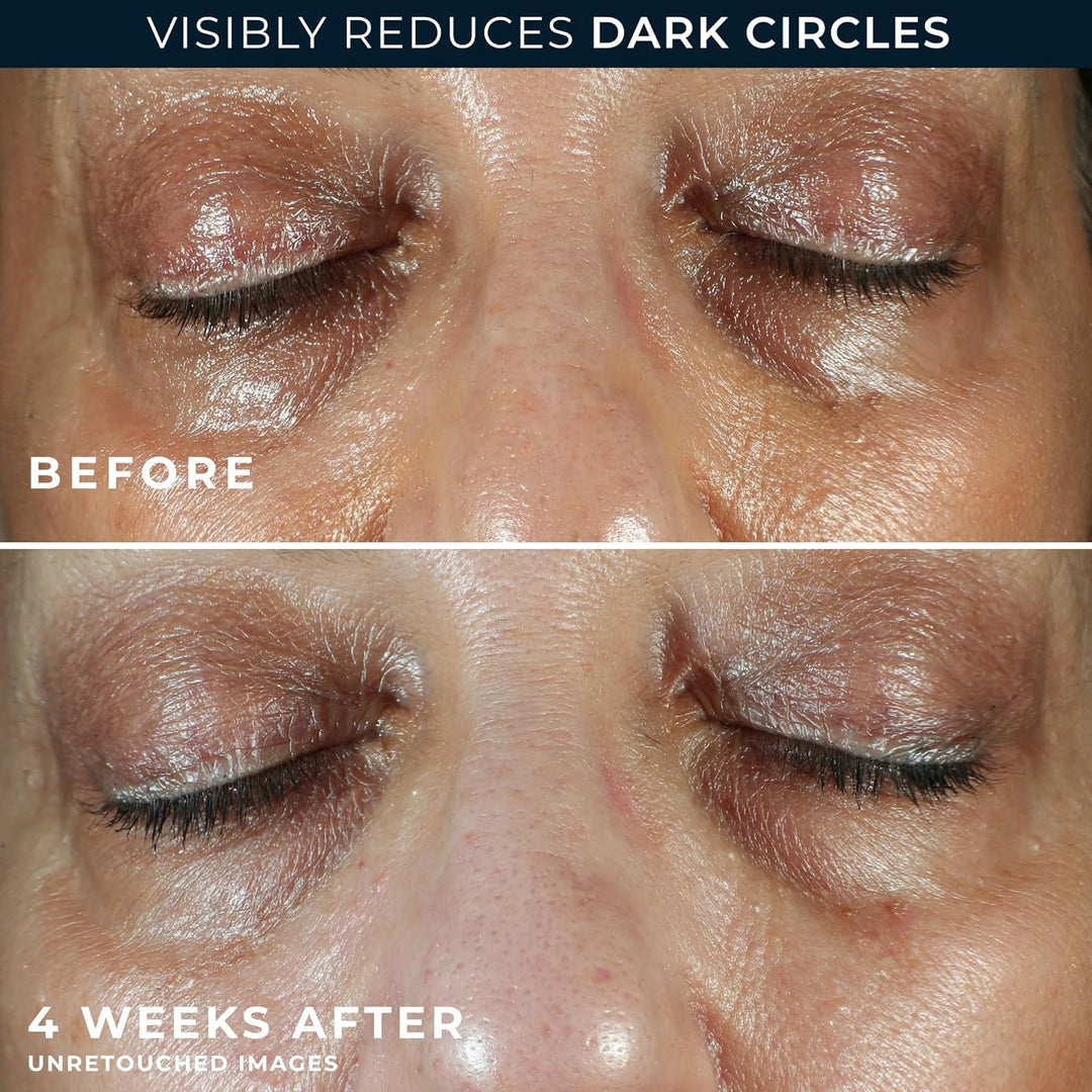 RoC Multi Correxion 5-in-1 Anti-Aging Eye Cream – For Puffiness, Under-Eye Bags & Dark Circles  (0.5 oz) + Night Cream Packette