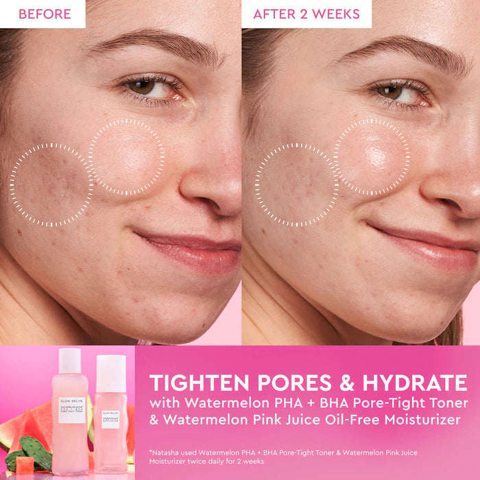 Glow Recipe Watermelon Glow PHA + BHA Pore-Tight Toner, 5.07 oz 150ml